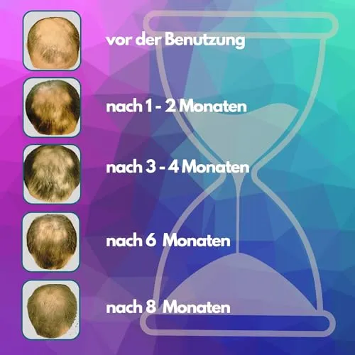 Duke-Handel Haartherapiegerät UC 5