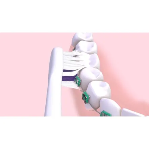 GUM Sonic Ortho 5