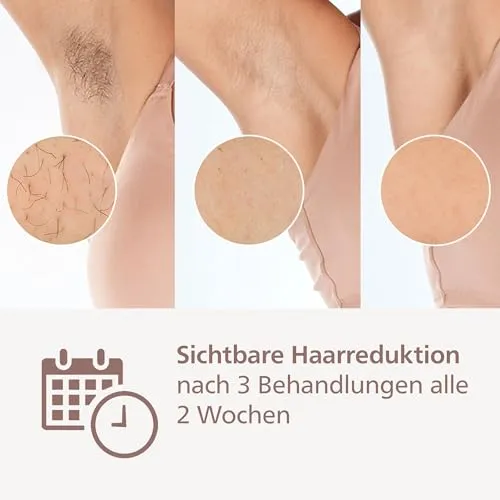 Philips Lumea IPL 9900